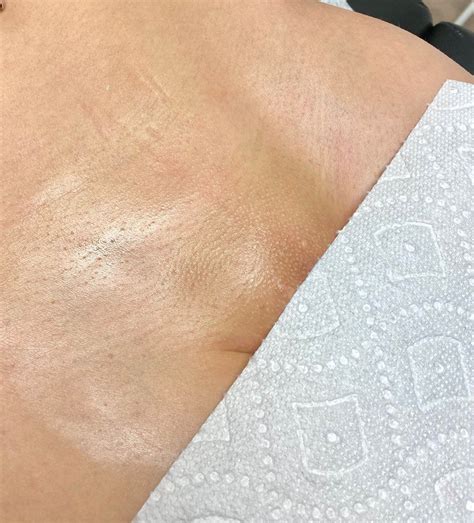 brazilian wax results